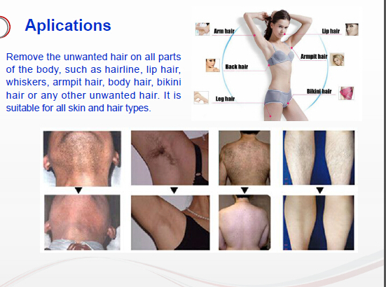 Vertical 808nm Wavelength Diode Laser Hair Removal Machine Vertical 808nm Wavelength Diode Laser Hair Removal Machine